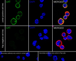LAT Antibody in Immunocytochemistry (ICC/IF)