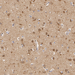 PKA alpha (catalytic subunit) Antibody in Immunohistochemistry (Paraffin) (IHC (P))