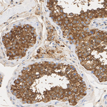 PKA alpha (catalytic subunit) Antibody in Immunohistochemistry (Paraffin) (IHC (P))