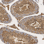 PKA alpha (catalytic subunit) Antibody in Immunohistochemistry (Paraffin) (IHC (P))