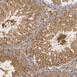 PKA alpha (catalytic subunit) Antibody in Immunohistochemistry (Paraffin) (IHC (P))