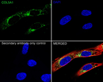 COL5A1 Antibody in Immunocytochemistry (ICC/IF)