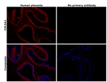 COL5A1 Antibody in Immunohistochemistry (Paraffin) (IHC (P))