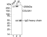 COL5A1 Antibody in Immunoprecipitation (IP)