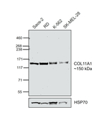 COL11A1 Antibody in Western Blot (WB)
