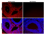 Talin 1 Antibody in Immunohistochemistry (Paraffin) (IHC (P))