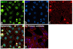 HDAC5 Antibody in Immunocytochemistry (ICC/IF)