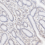 HDAC5 Antibody in Immunohistochemistry (Paraffin) (IHC (P))