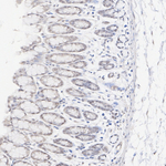 HDAC5 Antibody in Immunohistochemistry (Paraffin) (IHC (P))