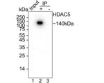 HDAC5 Antibody in Immunoprecipitation (IP)