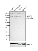 HDAC5 Antibody in Western Blot (WB)