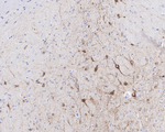 DLK1 Antibody in Immunohistochemistry (Paraffin) (IHC (P))