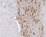 DLK1 Antibody in Immunohistochemistry (Paraffin) (IHC (P))