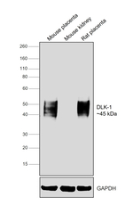 DLK1 Antibody in Western Blot (WB)