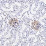 ITGB5 Antibody in Immunohistochemistry (Paraffin) (IHC (P))