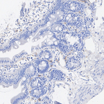 ITGB5 Antibody in Immunohistochemistry (Paraffin) (IHC (P))