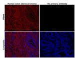 ITGB5 Antibody in Immunohistochemistry (Paraffin) (IHC (P))