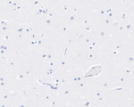 Langerin Antibody in Immunohistochemistry (Paraffin) (IHC (P))