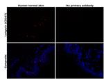 Langerin Antibody in Immunohistochemistry (Paraffin) (IHC (P))