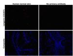 Langerin Antibody in Immunohistochemistry (Paraffin) (IHC (P))
