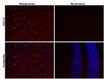 P2Y12 Antibody in Immunohistochemistry (Paraffin) (IHC (P))