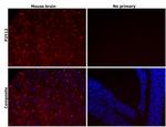 P2Y12 Antibody in Immunohistochemistry (Paraffin) (IHC (P))