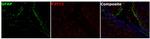 P2Y12 Antibody in Multiplex Immunohistochemistry (mIHC)