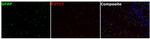 P2Y12 Antibody in Multiplex Immunohistochemistry (mIHC)