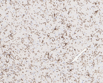P2Y12 Antibody in Immunohistochemistry (Paraffin) (IHC (P))