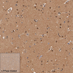 Phospho-AMPK alpha-1,2 (Thr183, Thr172) Antibody in Immunohistochemistry (Paraffin) (IHC (P))