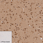 Phospho-AMPK alpha-1,2 (Thr183, Thr172) Antibody in Immunohistochemistry (Paraffin) (IHC (P))