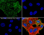 ITGB5 Antibody in Immunocytochemistry (ICC/IF)