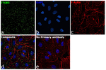 ITGB5 Antibody in Immunocytochemistry (ICC/IF)