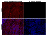 ITGB5 Antibody in Immunohistochemistry (Paraffin) (IHC (P))