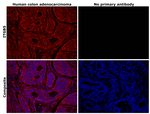 ITGB5 Antibody in Immunohistochemistry (Paraffin) (IHC (P))