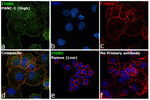 ITGB5 Antibody