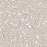 Synapsin 1/2 Antibody in Immunohistochemistry (Paraffin) (IHC (P))