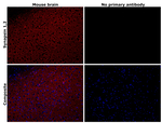 Synapsin 1/2 Antibody in Immunohistochemistry (Paraffin) (IHC (P))