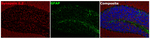 Synapsin 1/2 Antibody in Immunohistochemistry (Paraffin) (IHC (P))