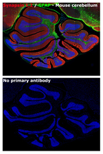 Synapsin 1/2 Antibody in Immunohistochemistry (Paraffin) (IHC (P))
