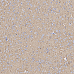 Synapsin 1/2 Antibody in Immunohistochemistry (Paraffin) (IHC (P))