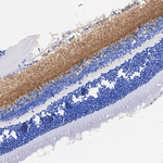 Synapsin 1/2 Antibody in Immunohistochemistry (Paraffin) (IHC (P))