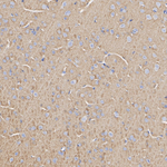 Synapsin 1/2 Antibody in Immunohistochemistry (Paraffin) (IHC (P))