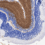 Synapsin 1/2 Antibody in Immunohistochemistry (Paraffin) (IHC (P))
