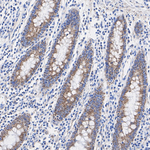 MCU Antibody in Immunohistochemistry (Paraffin) (IHC (P))