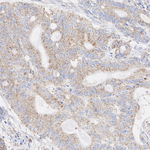 MCU Antibody in Immunohistochemistry (Paraffin) (IHC (P))