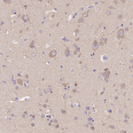 Dynactin 1 Antibody in Immunohistochemistry (Paraffin) (IHC (P))