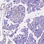 Golgin-97 Antibody in Immunohistochemistry (Paraffin) (IHC (P))