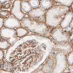 CD49a Antibody in Immunohistochemistry (Paraffin) (IHC (P))