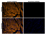 NDUFA9 Antibody in Immunohistochemistry (Paraffin) (IHC (P))